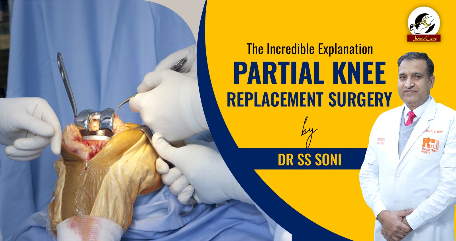 All about partial knee replacement surgery