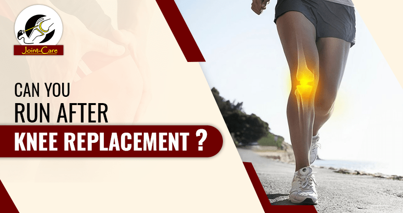 CAN YOU RUN AFTER KNEE REPLACEMENT?