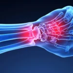 Wrist Surgeon in Jaipur