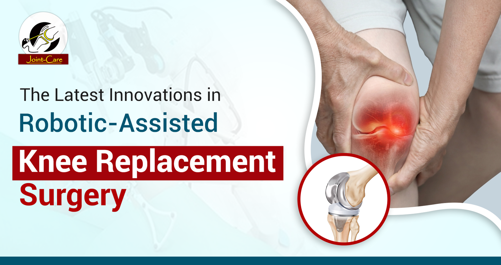 Modern Concepts involve in Robotic-Assisted Knee Replacement Surgery.